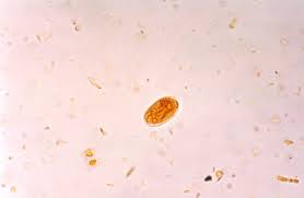 In U.S. it is Giardia is considered to be a common water-borne disease.
